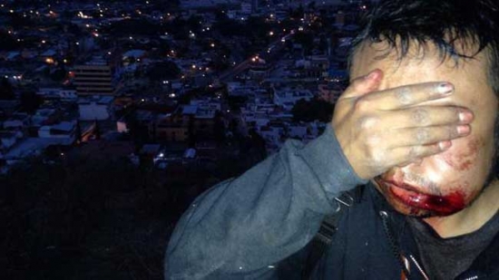 Chilpancingo: Policía Federal agrede a estudiantes normalistas
