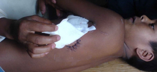 Miembros de la OPDDIC lesionan gravemente a un niño zapatista